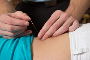 Study: Acupuncture Did Not Improve Chronic Knee Pain