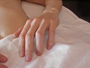 Tailored Acupuncture Lessens Pain Intensity in Chronic Pain