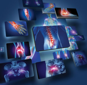 Natural Solutions for Bone, Joint & Muscle Support