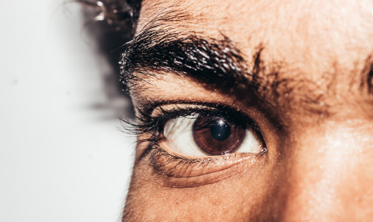 Age-related Macular Degeneration